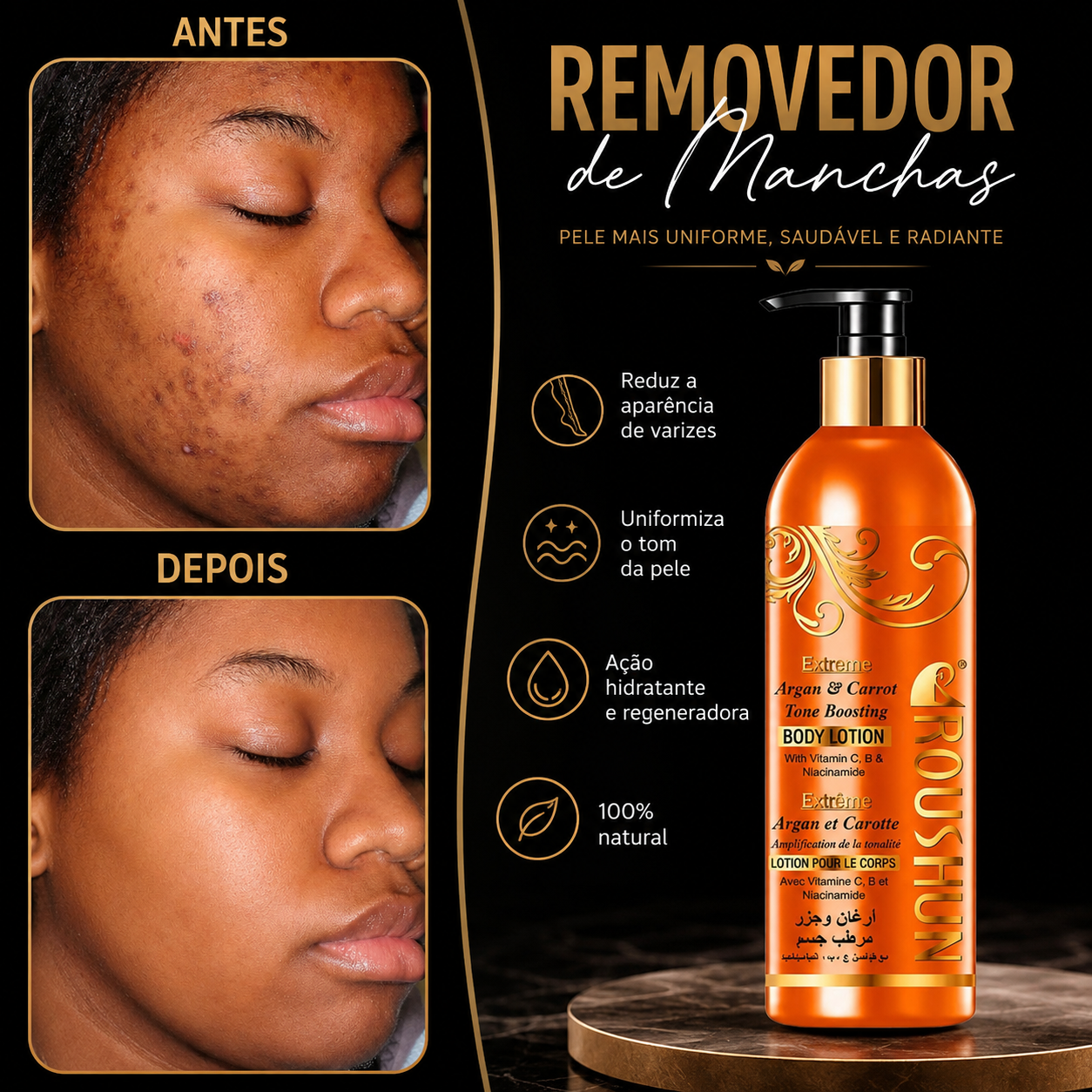 Creme removedor de manchas