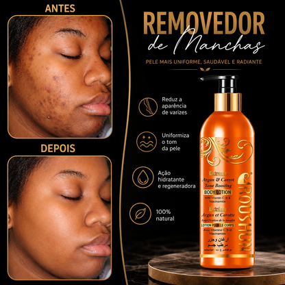 Creme removedor de manchas