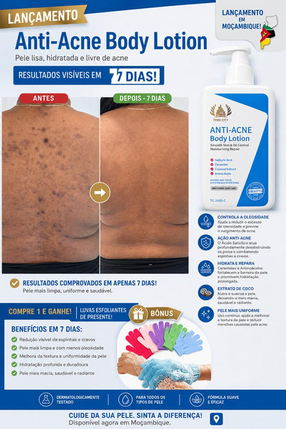 Anti-Acne Body Lotion™ + Luvas Esfoliantes Grátis
